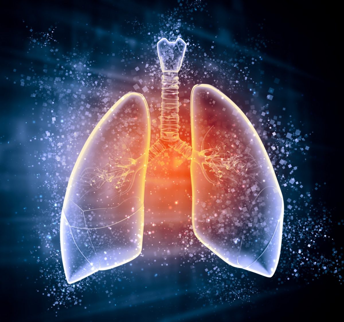 in-bronchiectasis-chest-physiotherapy-may-help-stabilize-lung-function