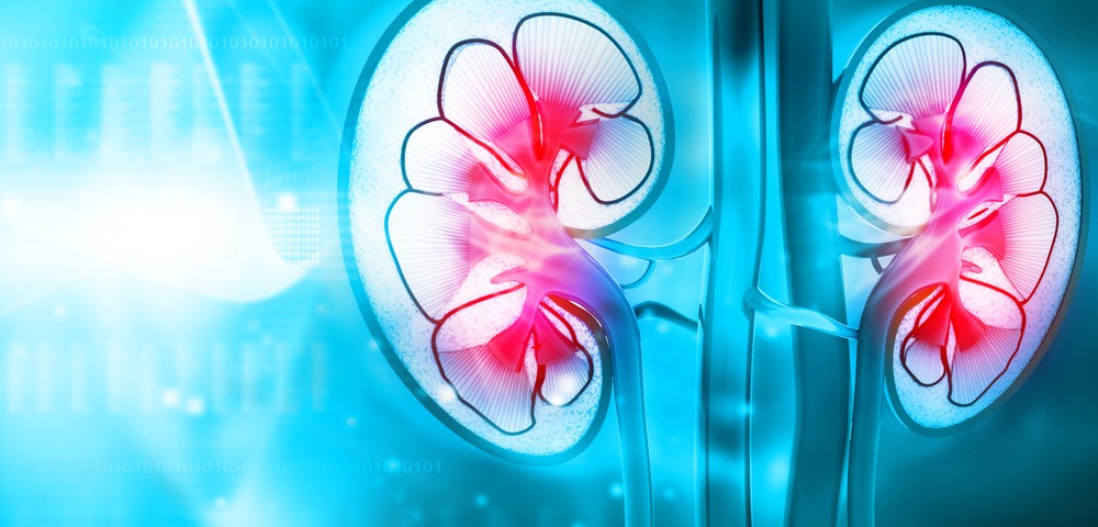 Hospitalized Bronchiectasis Patients Who Develop Acute Kidney Injury at Increased Risk for Mortality