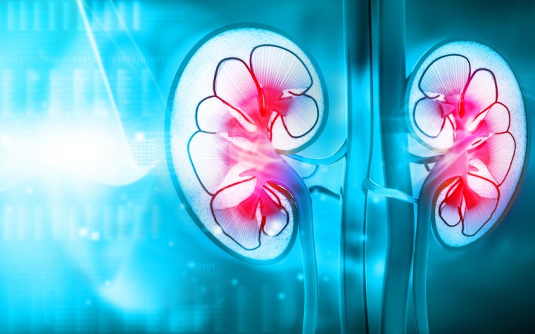 Bronchiectasis and kidney injury