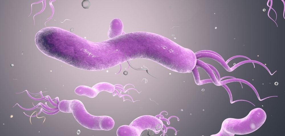 Changes in Composition of Airway Bacteria Evident in Bronchiectasis Patients, Study Reports