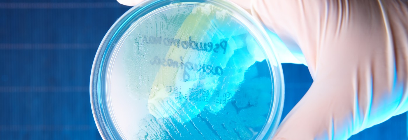 Researchers Evaluate Bronchiectasis Risk Factors, Including Bacterial Colonization