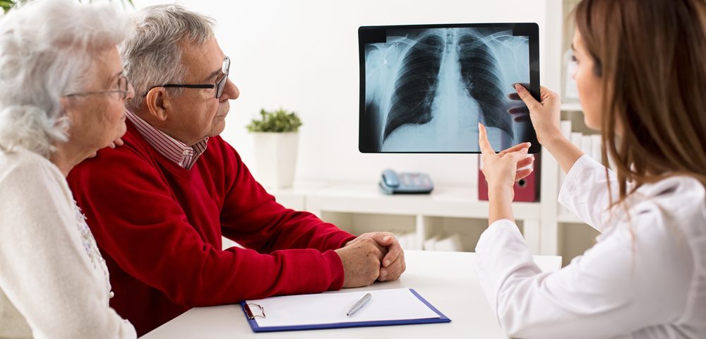 Bronchiectasis More Common in Severe COPD, Pneumonia as Treatment Side Effect