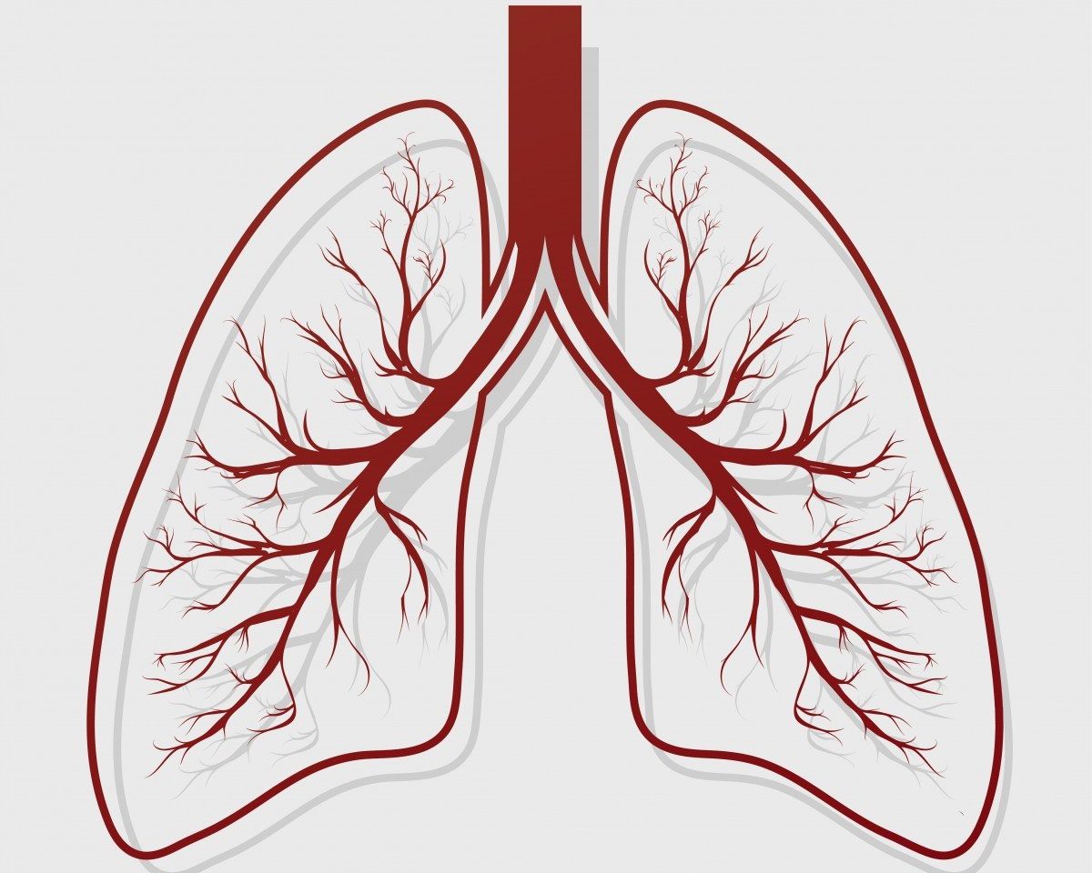 Bronchiectasis Common in COPD Patients with Frequent Flares and Hospitalizations, Study Finds