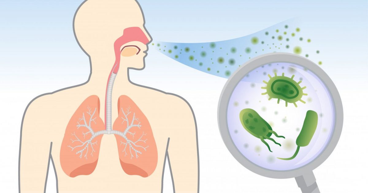 P. aeruginosa in Airways of Non-CF Bronchiectasis Patients Linked to ...