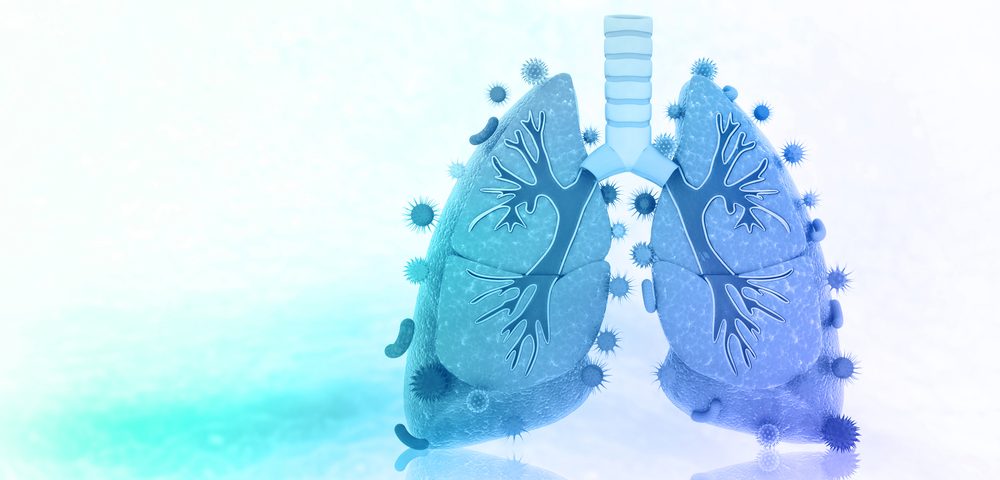 Investigational Imaging Technology Allows Deep Look at Lungs, Quickly Detecting Bacteria