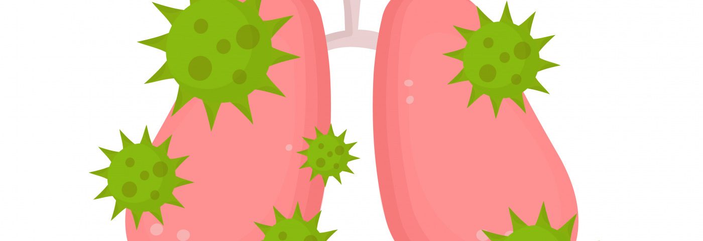 Case Study Reports COVID-19 Plus Rare Bacterial Infection in Bronchiectasis Patient