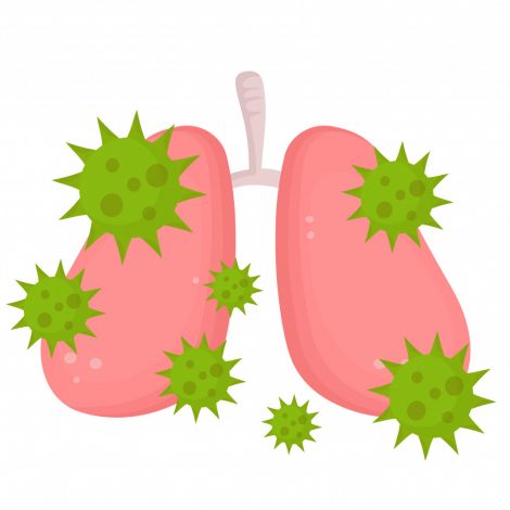 5 Tips to Help Prevent Lung Infections - Bronchiectasis News Today